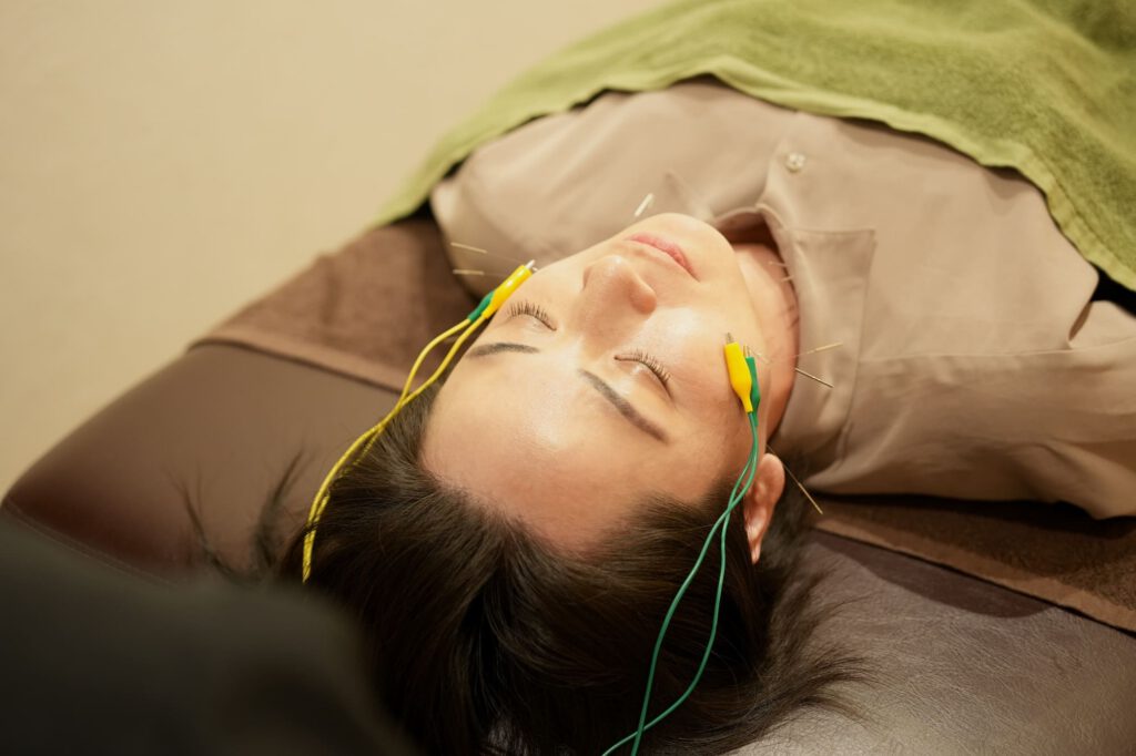 美容鍼のイメージ写真